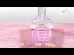 MLS05 η φορητή δημιουργία κοιλότητας κενό RF υπερηχητικό Cellulite 40K μειώνει τη συσκευή