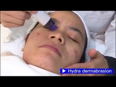 CV07 4IN1 Face Suction Photon Rejuvenation Συσκευή λεύκανσης προσώπου με οξυγόνο