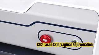 Μεταλλικός RF Fractional CO2 Laser για Ανάπλαση Δέρματος και Σύσφιξη του Κόλπου