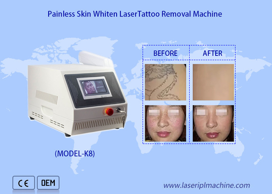 1320nm 1064nm 532nm φορητό Nd Yag Laser εξαφάνιση τατουάζ λευκαστική μηχανή δέρματος