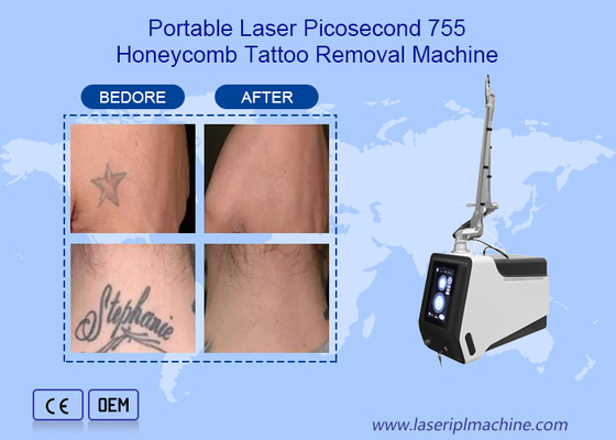 Picosecond ND Yag συσκευή 755nm 1064nm 532nm μηχανών αφαίρεσης δερματοστιξιών λέιζερ