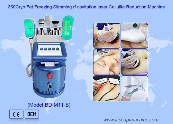360 Cryo Vacuum Rf Lipo Laser 6 σε 1 Μηχανή κατάψυξης λίπους για απώλεια βάρους