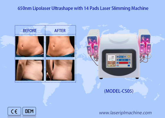 το λέιζερ 650nm Lipo γεμίζει τη μηχανή Liposuction λέιζερ για μειώνει την παχιά αφαίρεση Cellulite