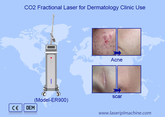 10600nm Μεικτό Ultrapulsed Co2 Laser Machine για την αποκατάσταση της επιφάνειας του δέρματος