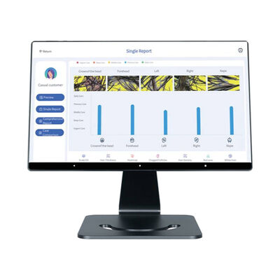 Έξυπνη συσκευή ανάλυσης τριχωτού κεφαλής Smart AI 4 γλωσσών για στοχευμένη φροντίδα τριχωτού